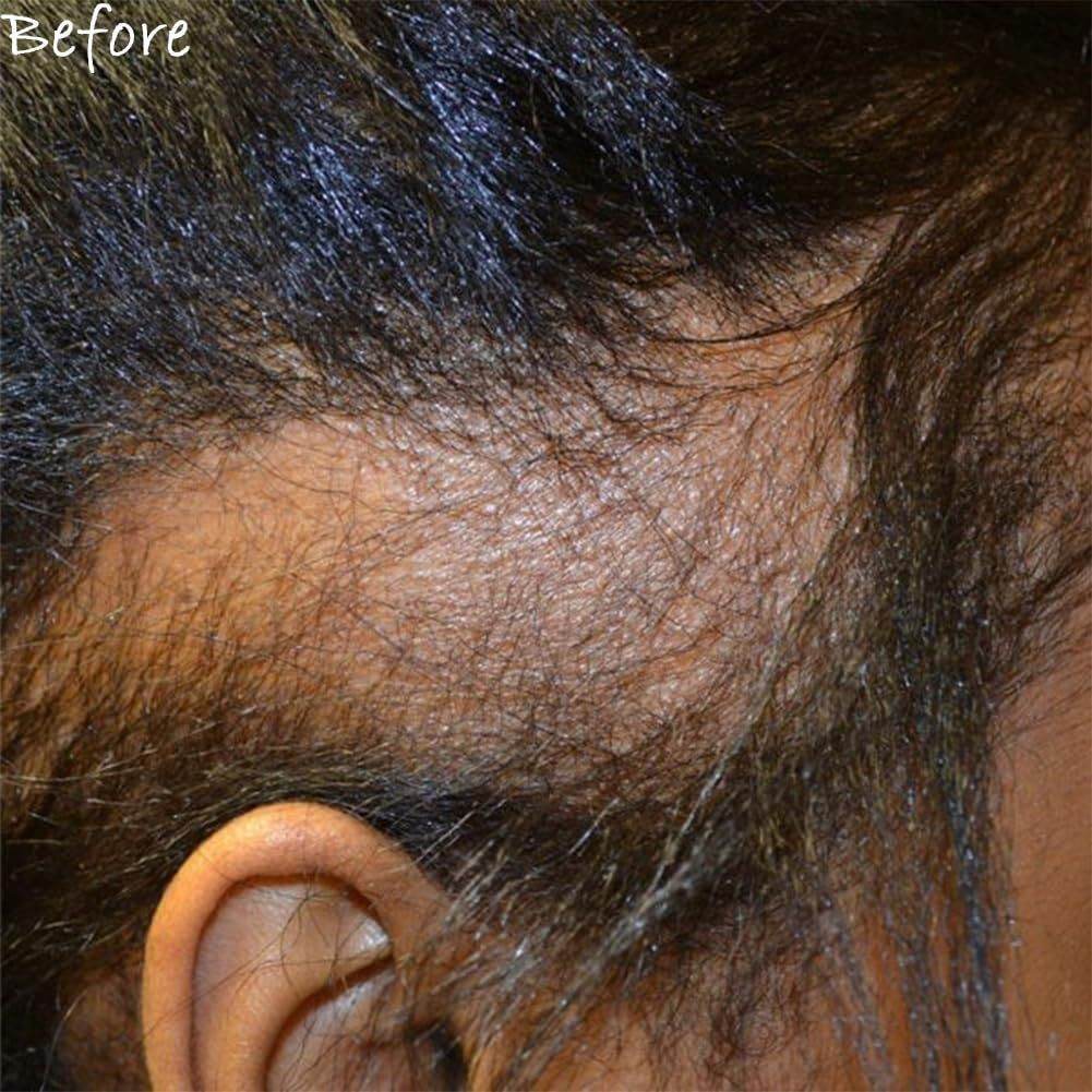 10 N 1Cherbe Oil For Hair Growth Liquid - NamafadStore