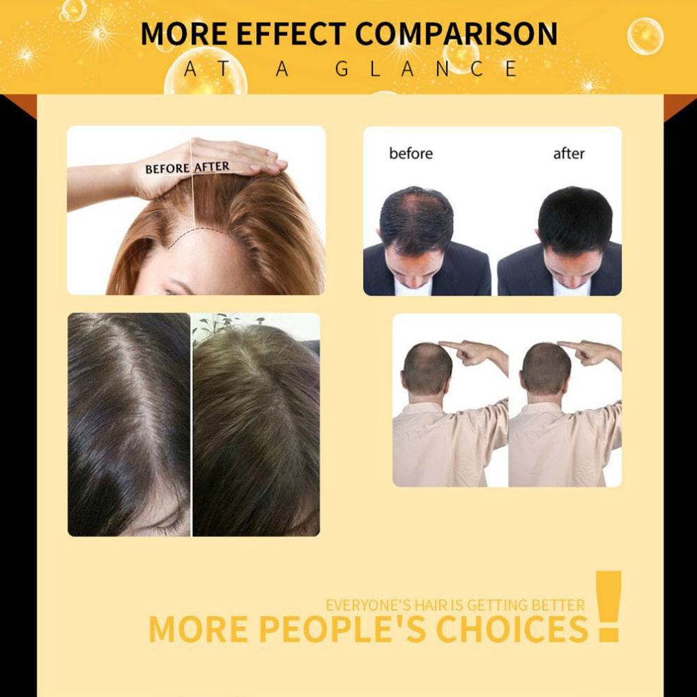 Damaged Hair Repair Women Men's Fast Hair Growth Essence Oil Anti-hair Loss Lotion - NamafadStore