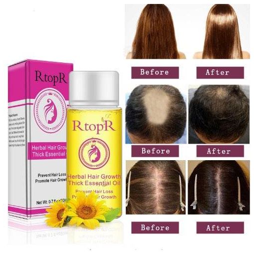 Fast Powerful Hair Growth Essential Oil Liquid Treatment 20ml for Preventing Hair Loss and Hair Care - NamafadStore