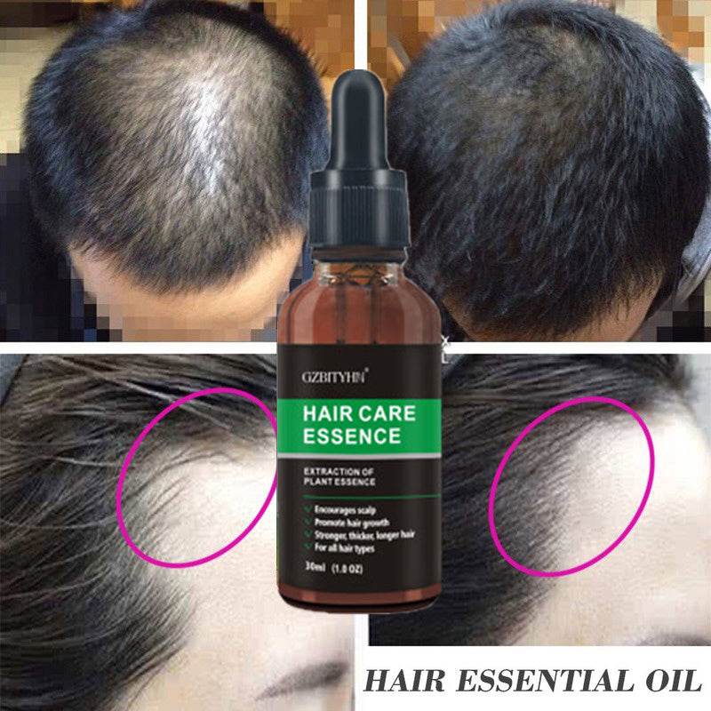 Hair Growth Oil - OEM Hair Care Essential Oil for Hair Growth - NamafadStore