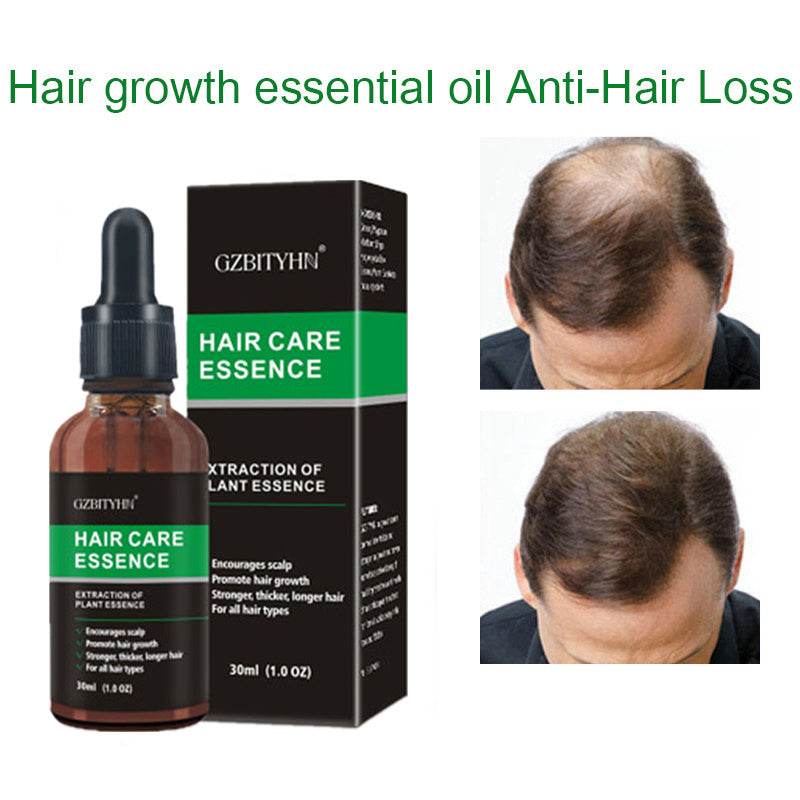 Hair Growth Oil - OEM Hair Care Essential Oil for Hair Growth - NamafadStore