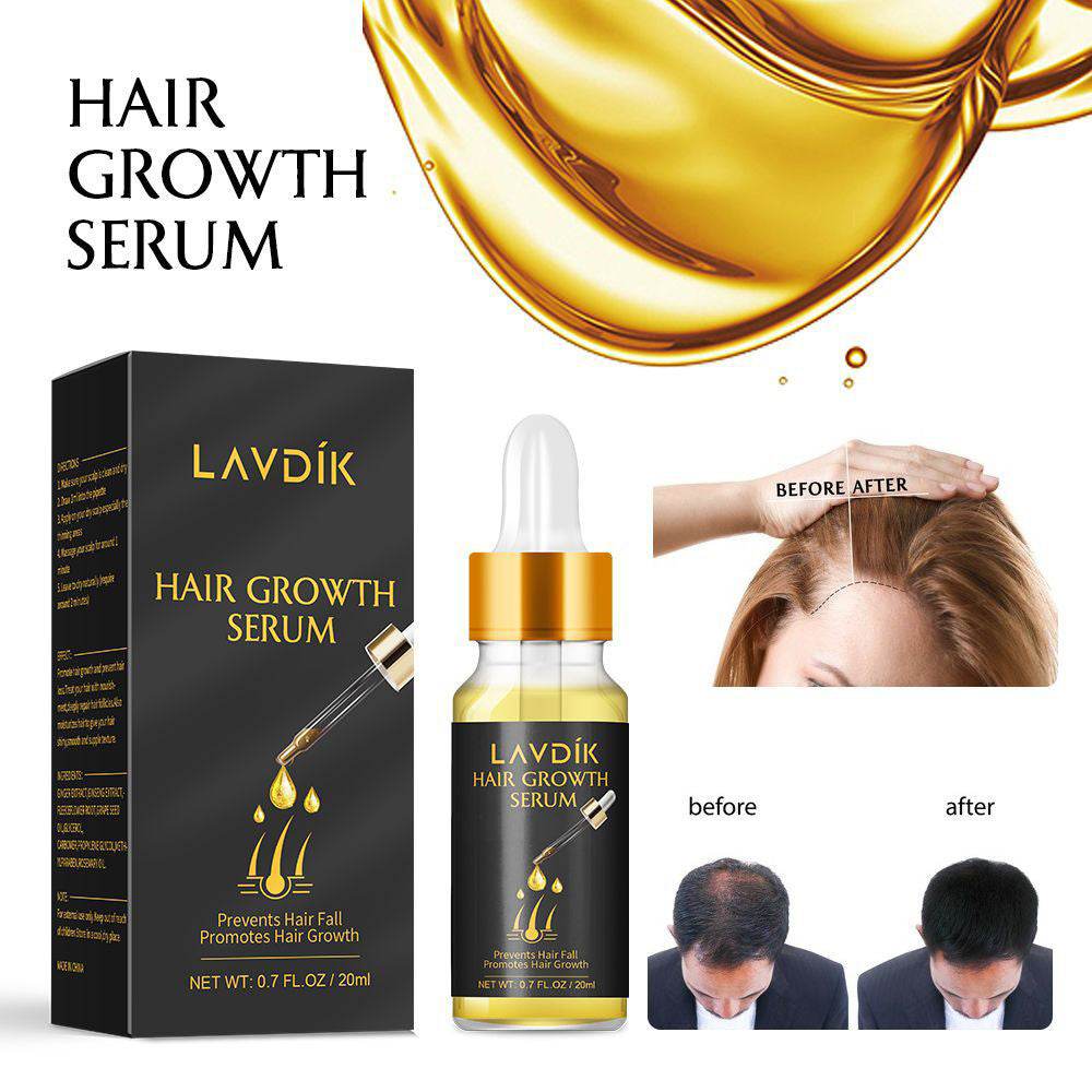 Damaged Hair Repair Women Men's Fast Hair Growth Essence Oil Anti-hair Loss Lotion - NamafadStore