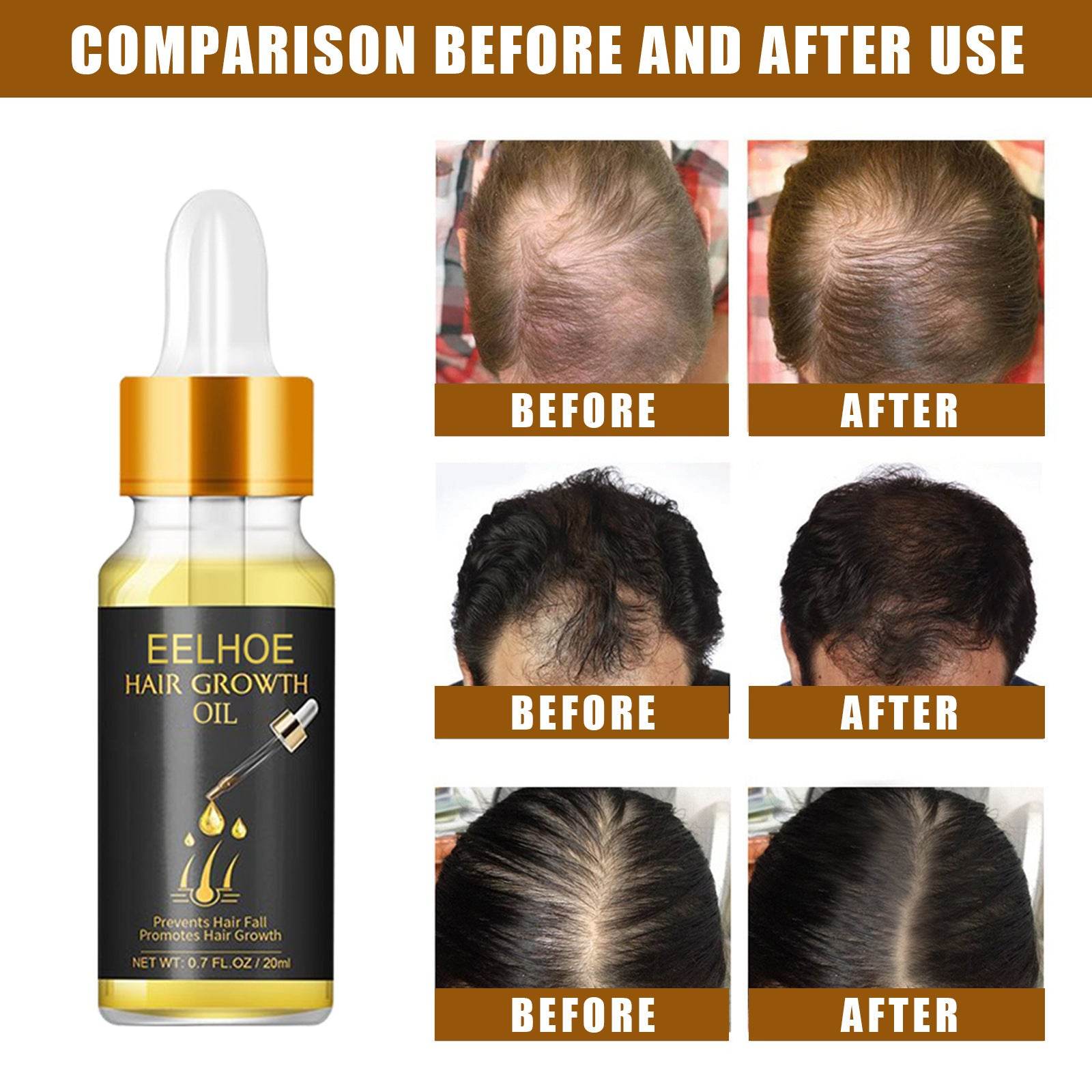 Hair Growth Essential Oil  Care Essential Nutrient Liquid - NamafadStore