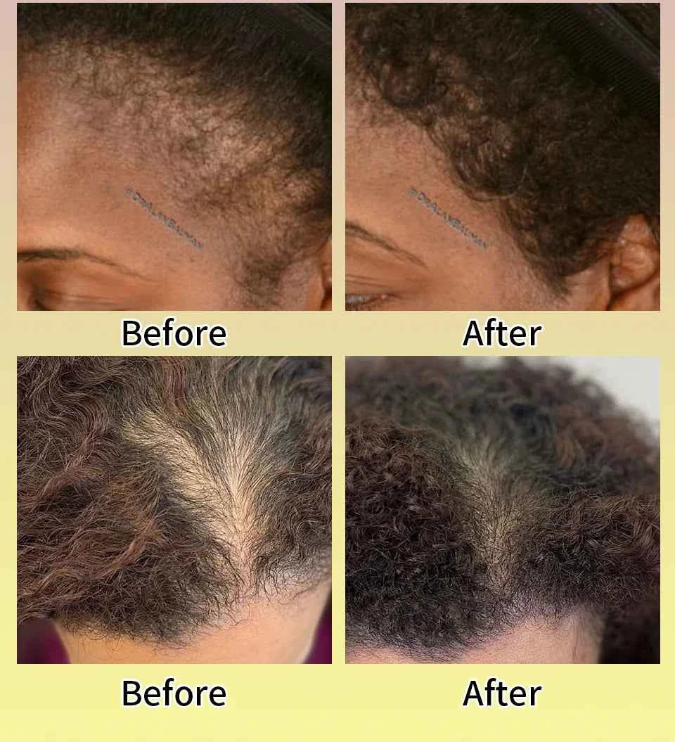 Maca Hair Growth Oil Set For Peru Maca Powder Hair Growth Butter Maca Root Hair Oil Castor Oil Anti-Hair Loss Sevich Hair Care