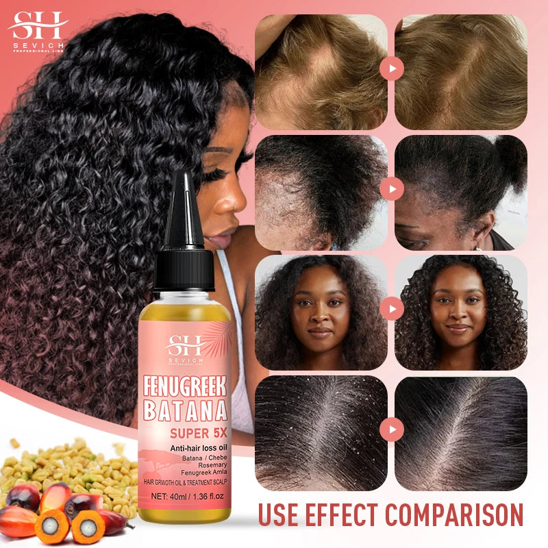 Hot Super 5x Hair Growth Oil Chebe Batana Butter Hair Mask Fenugreek Seeds Fast Anti-Hair Loss Oil Rosemary Hair Regrowth Oils - NamafadStore