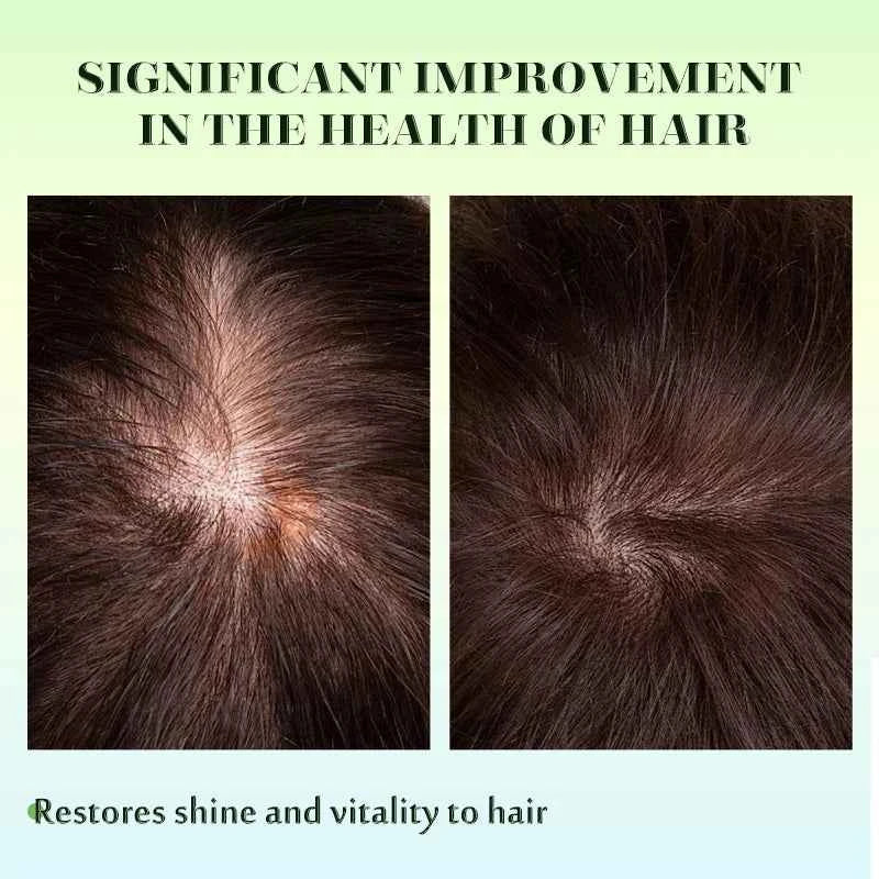 Rosemary Mint oil Scalp Hair Strengthening Hair Growth Essential Nourishing Treatment For Split Ends Dry Organics Hair Care Oil