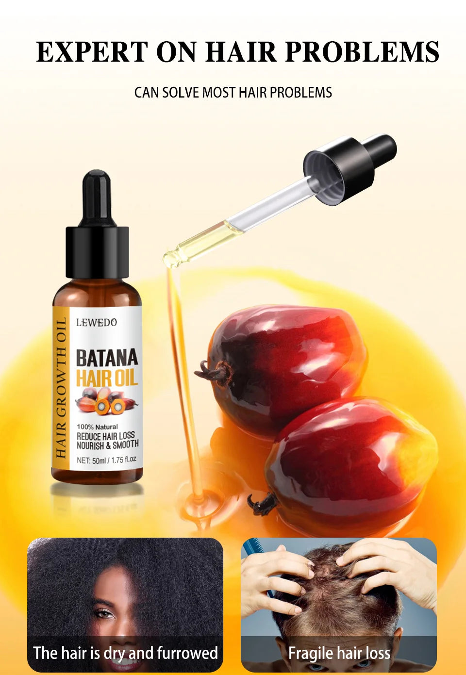 Fast Hair Growth Oil Africa Crazy Traction Alopecia batana Hair Mask Anti Hair Break Hair Strengthener Hair Loss Treatment Spray - NamafadStore
