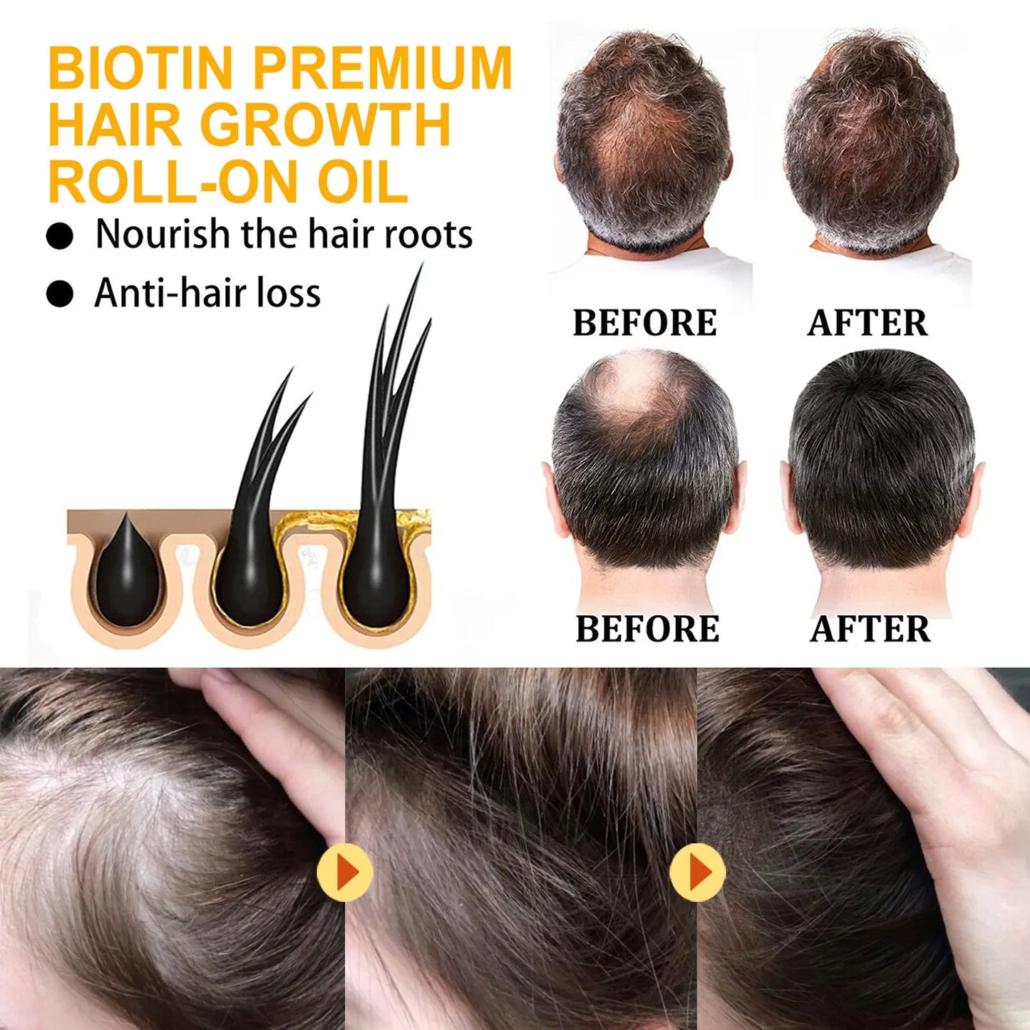 Biotin Fast Hair Growth Products Anti Hair Loss Serum Spray Prevent Baldness Treatment Scalp Beard Beauty Hair Care Product - NamafadStore
