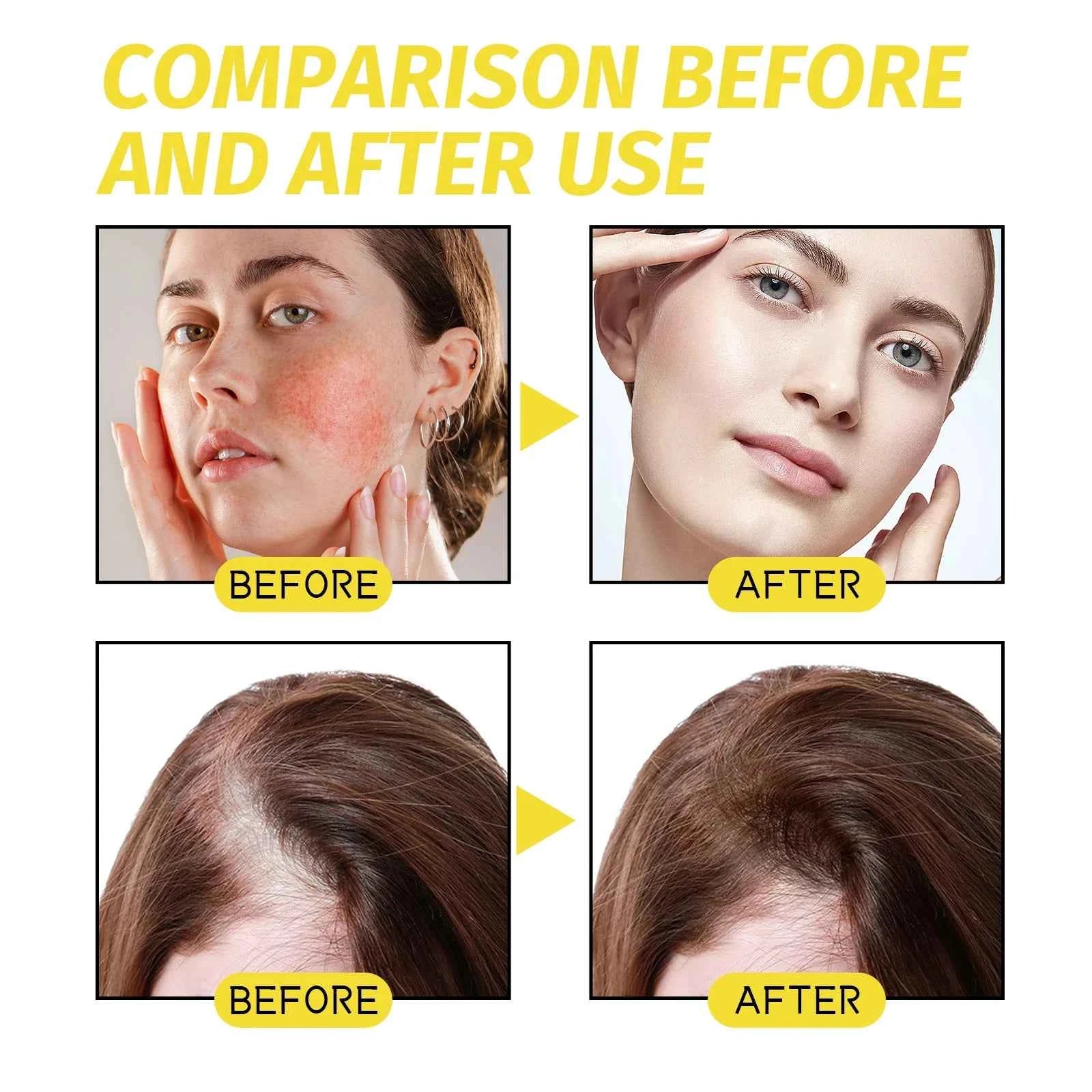 Hair growth essential oil. Effectively repair baldness and hair loss symptoms