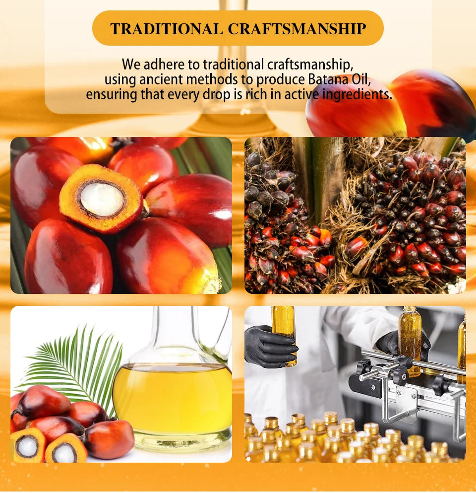 Fast Hair Growth Oil Africa Crazy Traction Alopecia batana Hair Mask Anti Hair Break Hair Strengthener Hair Loss Treatment Spray - NamafadStore