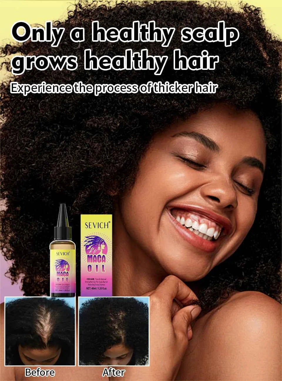 Maca Hair Growth Oil Set For Peru Maca Powder Hair Growth Butter Maca Root Hair Oil Castor Oil Anti-Hair Loss Sevich Hair Care