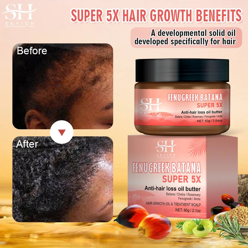 Hot Super 5x Hair Growth Oil Chebe Batana Butter Hair Mask Fenugreek Seeds Fast Anti-Hair Loss Oil Rosemary Hair Regrowth Oils - NamafadStore