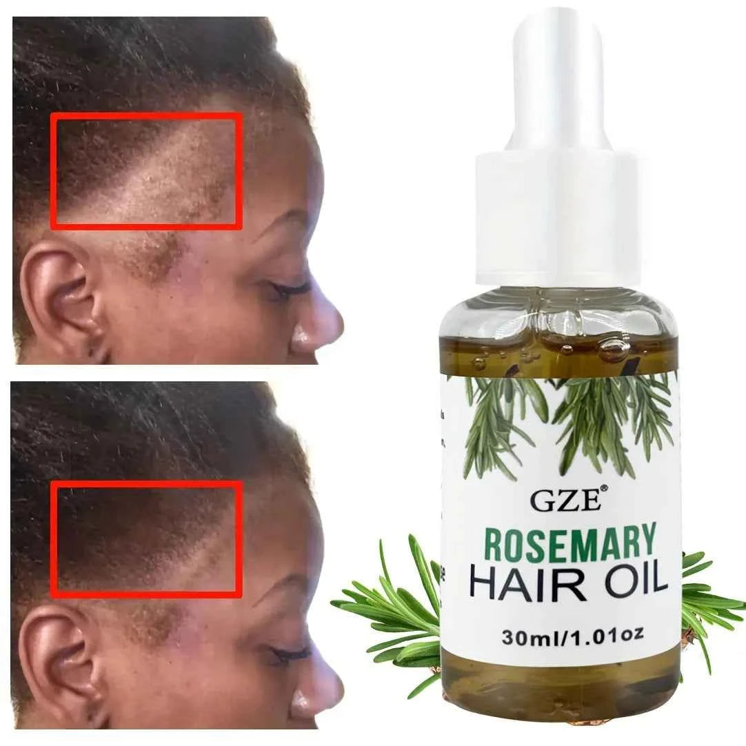 GZE Rosemary Oil For Hair Strengthens Rosemary Scalp Care | All Type & Texture | Straight, Waves & Chemically - NamafadStore