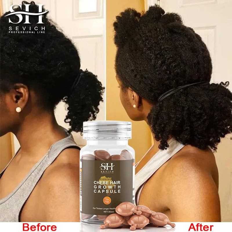 Fast Hair Growth Oil African Crazy Traction Alopecia Chebe Hair Mask Anti Hair Break Hair Strengthener Hair Loss Treatment Spray - NamafadStore