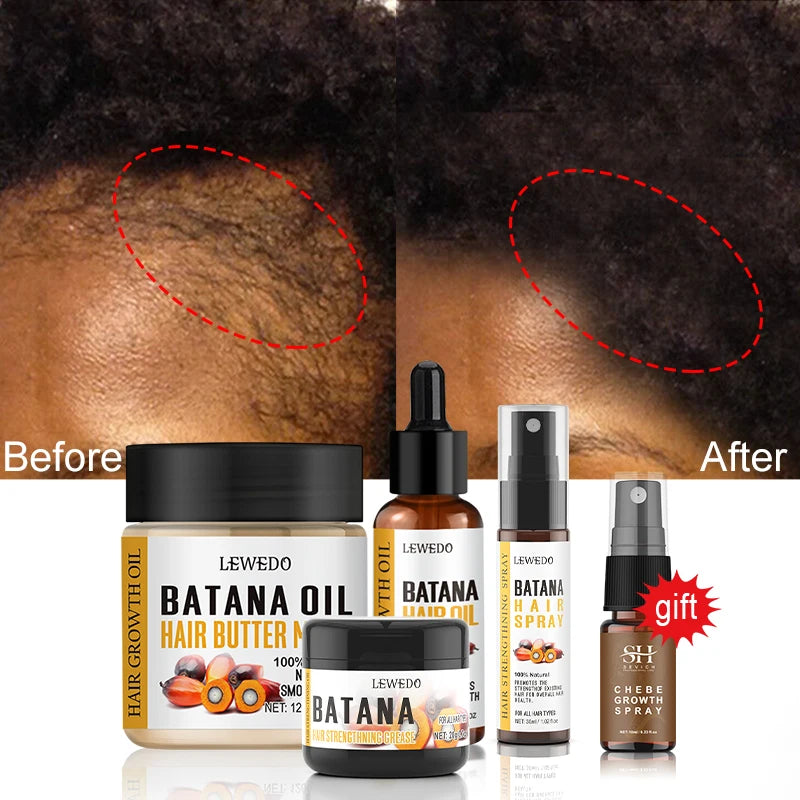 Fast Hair Growth Oil Africa Crazy Traction Alopecia batana Hair Mask Anti Hair Break Hair Strengthener Hair Loss Treatment Spray - NamafadStore