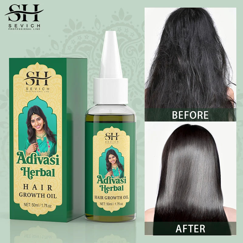 Ayurvedic Hair Growth Oil India Adivasi Organic Hair Growth Serum Anti Hair Loss Fast Regrowth Thicken Oils Hair Growth Products - NamafadStore