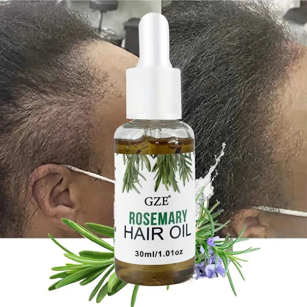 GZE Rosemary Oil For Hair Strengthens Rosemary Scalp Care | All Type & Texture | Straight, Waves & Chemically - NamafadStore