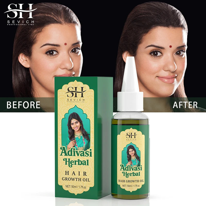 Ayurvedic Hair Growth Oil India Adivasi Organic Hair Growth Serum Anti Hair Loss Fast Regrowth Thicken Oils Hair Growth Products - NamafadStore