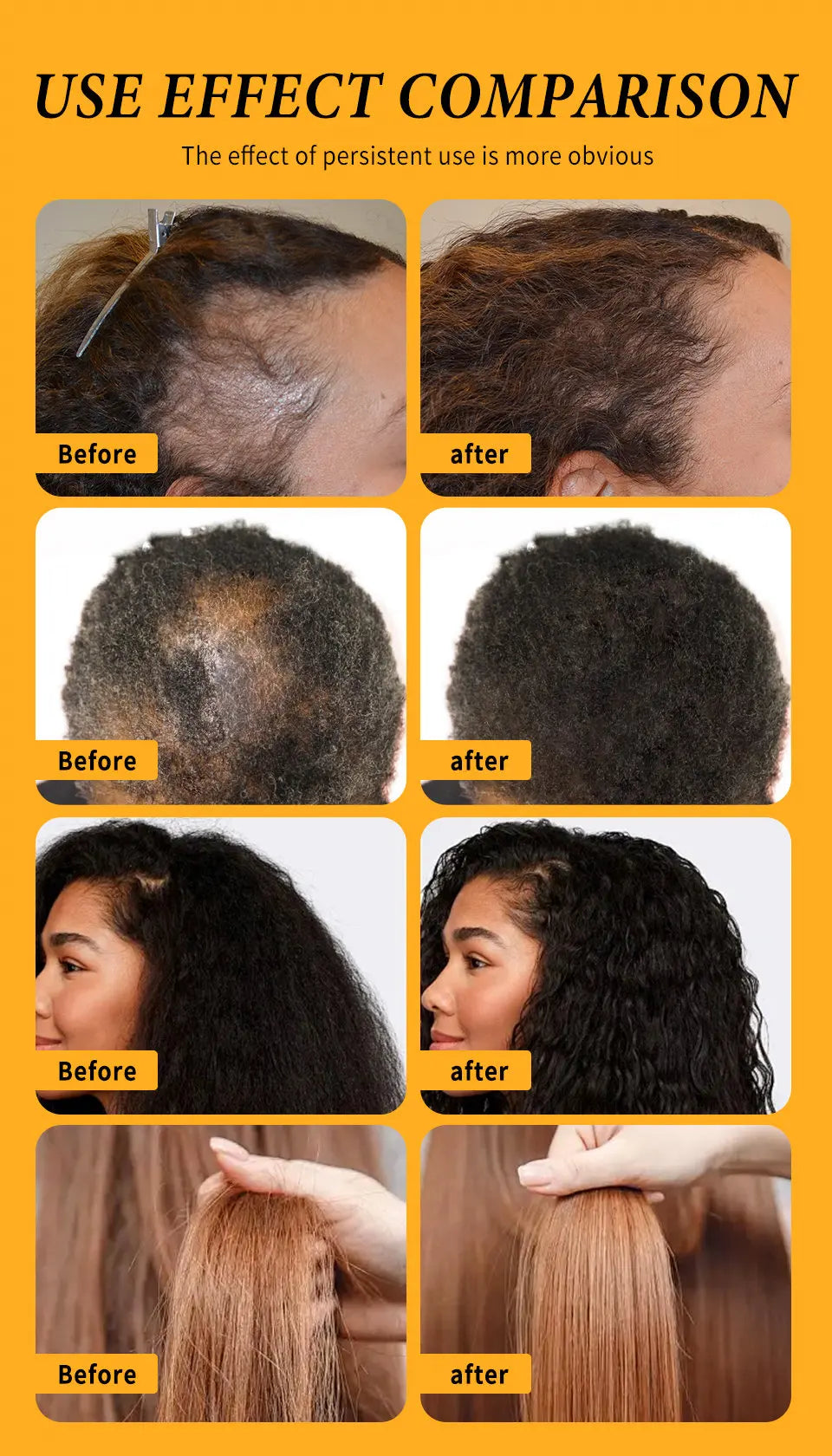 Fast Hair Growth Oil Africa Crazy Traction Alopecia batana Hair Mask Anti Hair Break Hair Strengthener Hair Loss Treatment Spray - NamafadStore