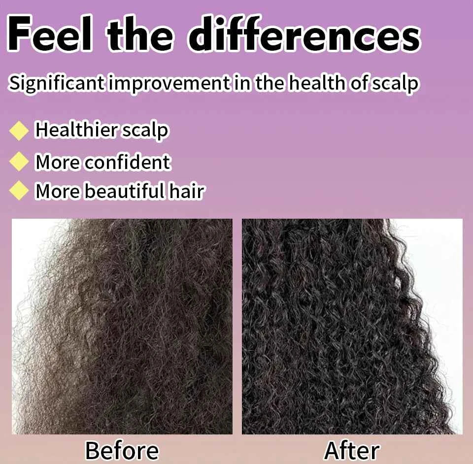 Maca Hair Growth Oil Set For Peru Maca Powder Hair Growth Butter Maca Root Hair Oil Castor Oil Anti-Hair Loss Sevich Hair Care