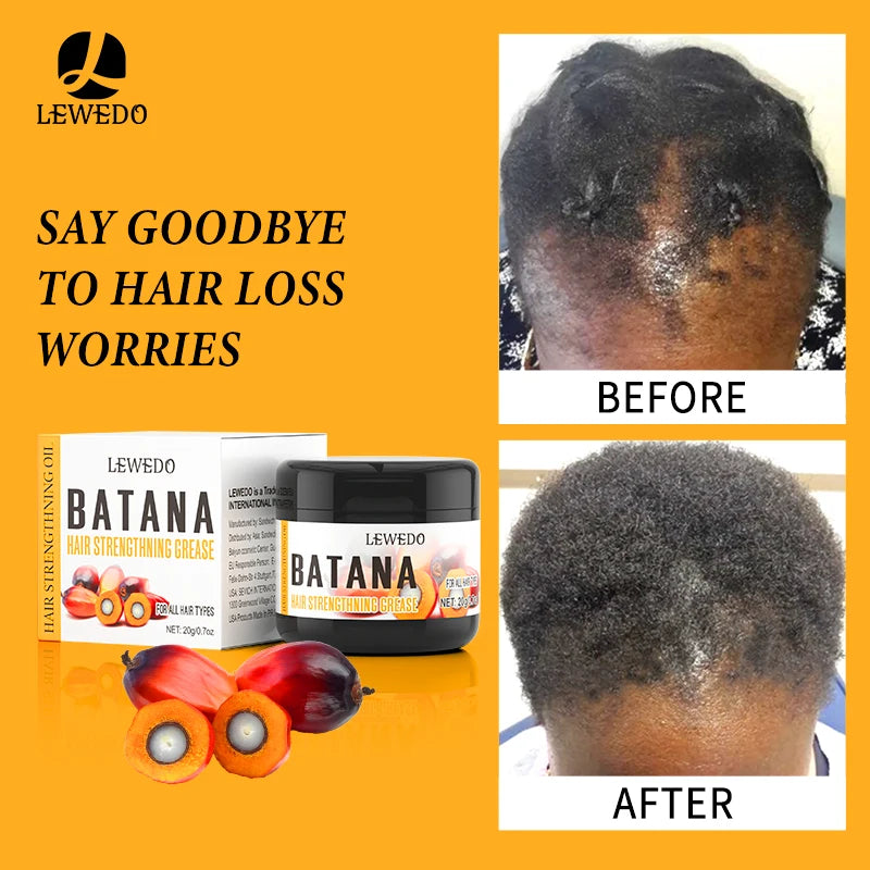 Fast Hair Growth Oil Africa Crazy Traction Alopecia batana Hair Mask Anti Hair Break Hair Strengthener Hair Loss Treatment Spray - NamafadStore