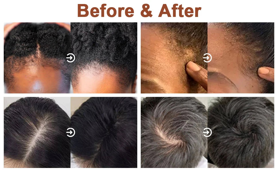 3pcs/set Hair Care Products for Women Moisturize Nourish Rosemary Oil Natural Batana Oil & Chebe Serum Anti-frizz Treatment Hair - NamafadStore