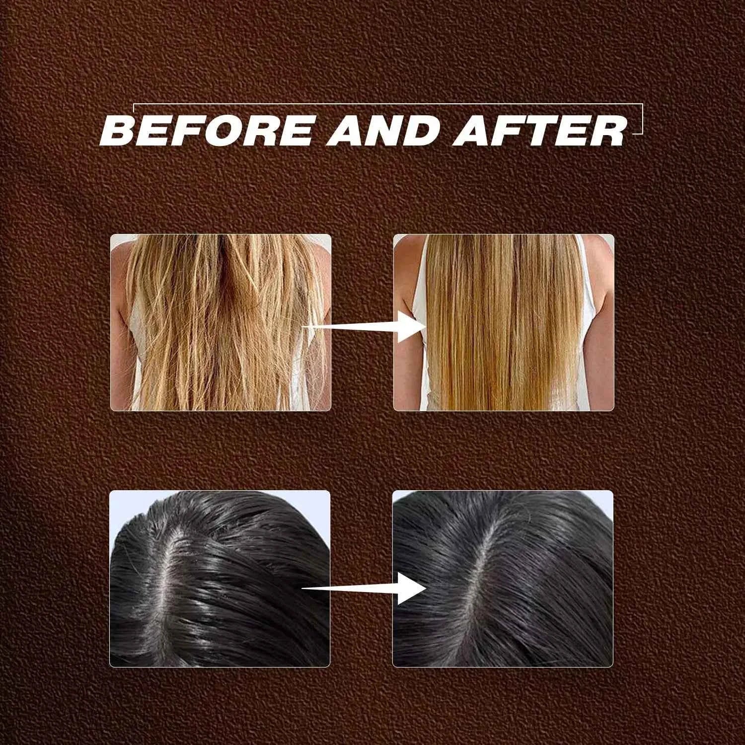 30ML Batana Oil with Rosemary for Hair Growth Reduce Hair Loss Organic Oil for Strengthening Scalp Moisturizing Hair Care Oil - NamafadStore