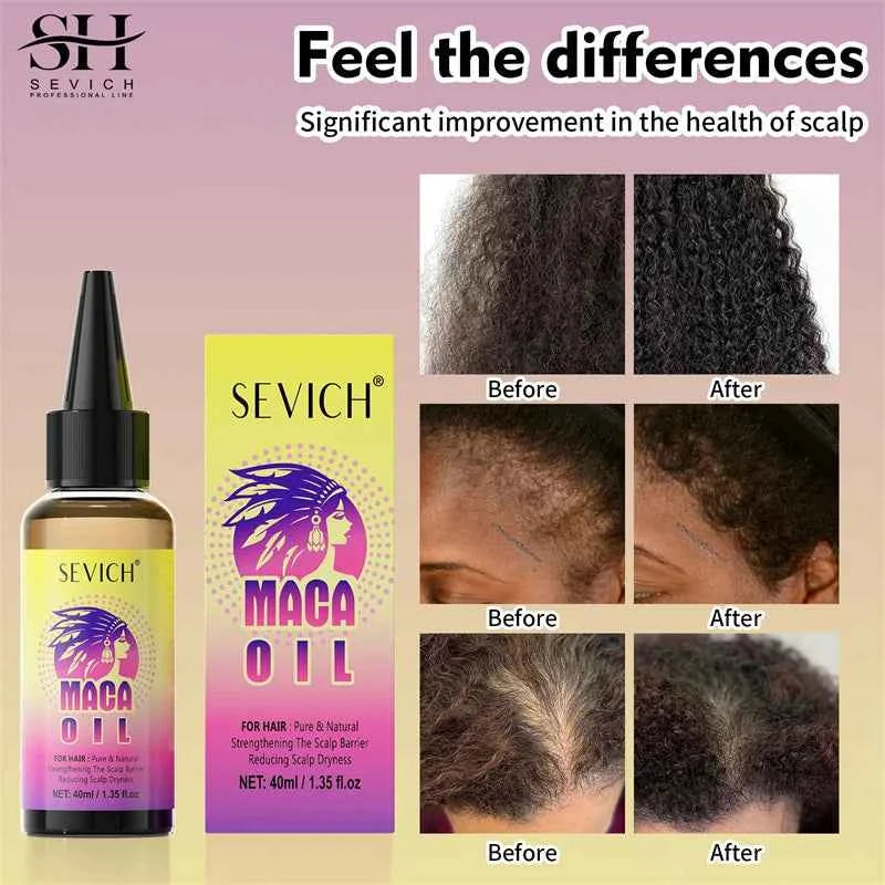Maca Hair Growth Oil Set For Peru Maca Powder Hair Growth Butter Maca Root Hair Oil Castor Oil Anti-Hair Loss Sevich Hair Care
