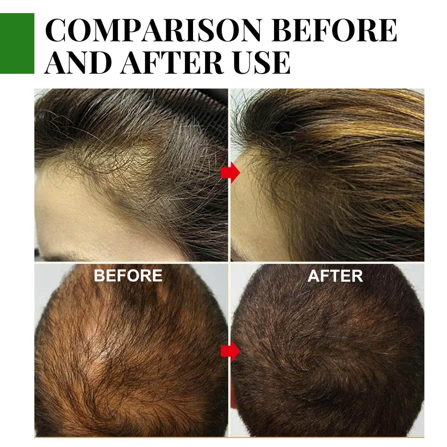 Rosemary Hair Growth Oil for Hair Loss Prevention and Scalp Nourishment - NamafadStore