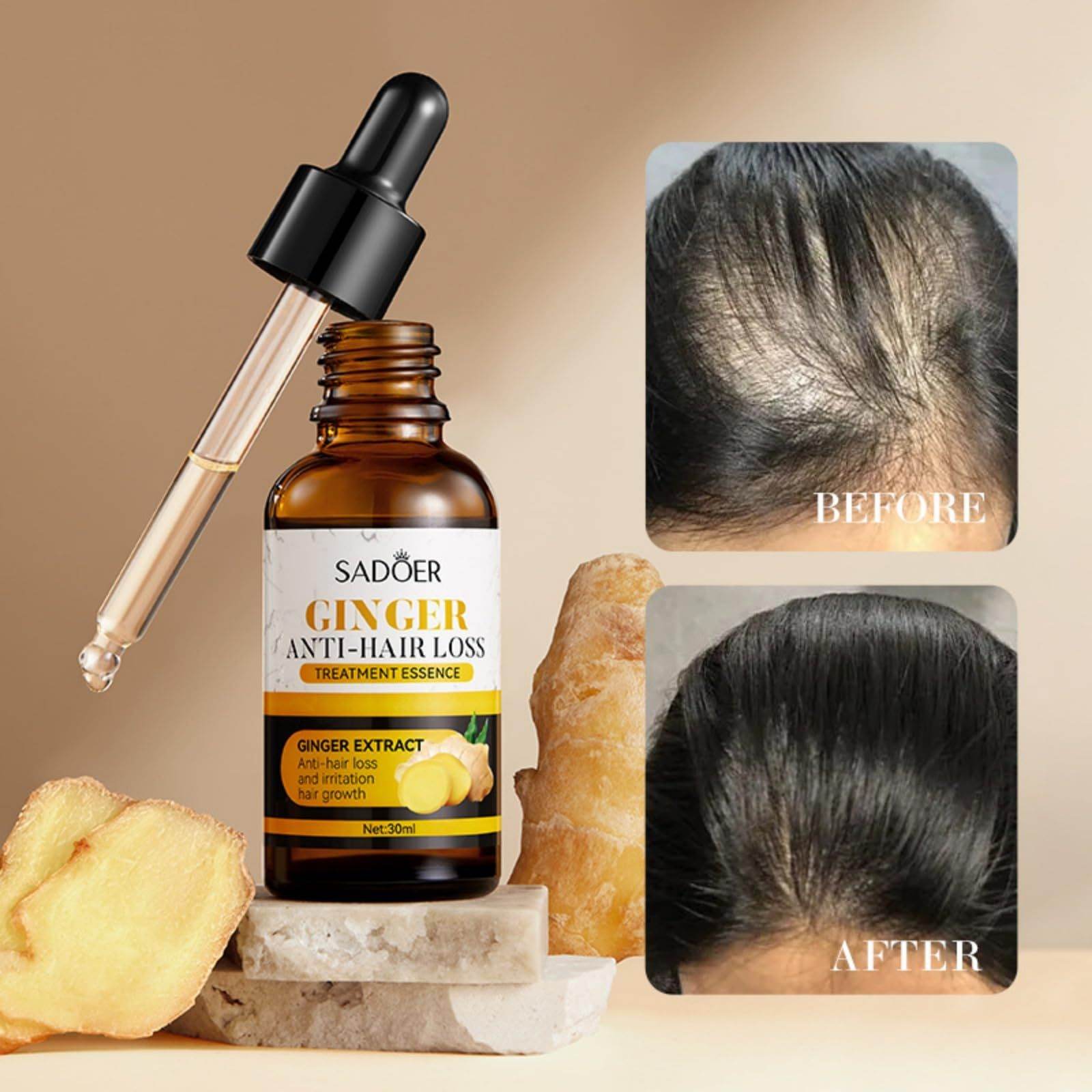 Ginger Hair Growth Oil for Hair Loss Care and Growth - NamafadStore