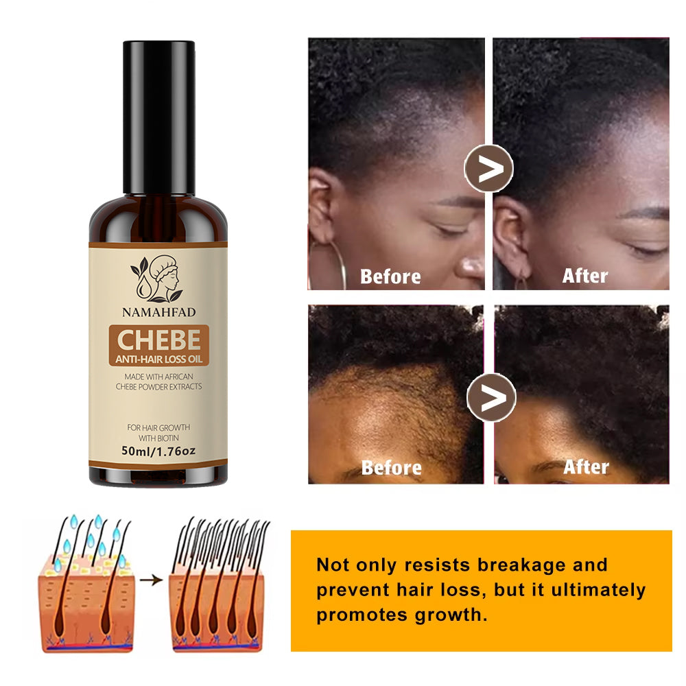 Namahfad Chebe Hair Mask & Growth Oil Set – Deep Moisture, Strengthening & Breakage Reduction | Natural Chebe Powder Extracts