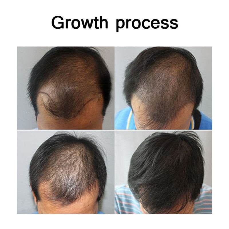 Hair Growth Essential Oil Conditioner for Hair Care and Nourishment - NamafadStore