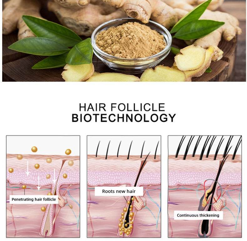 Hair Growth Oil - OEM Hair Care Essential Oil for Hair Growth - NamafadStore