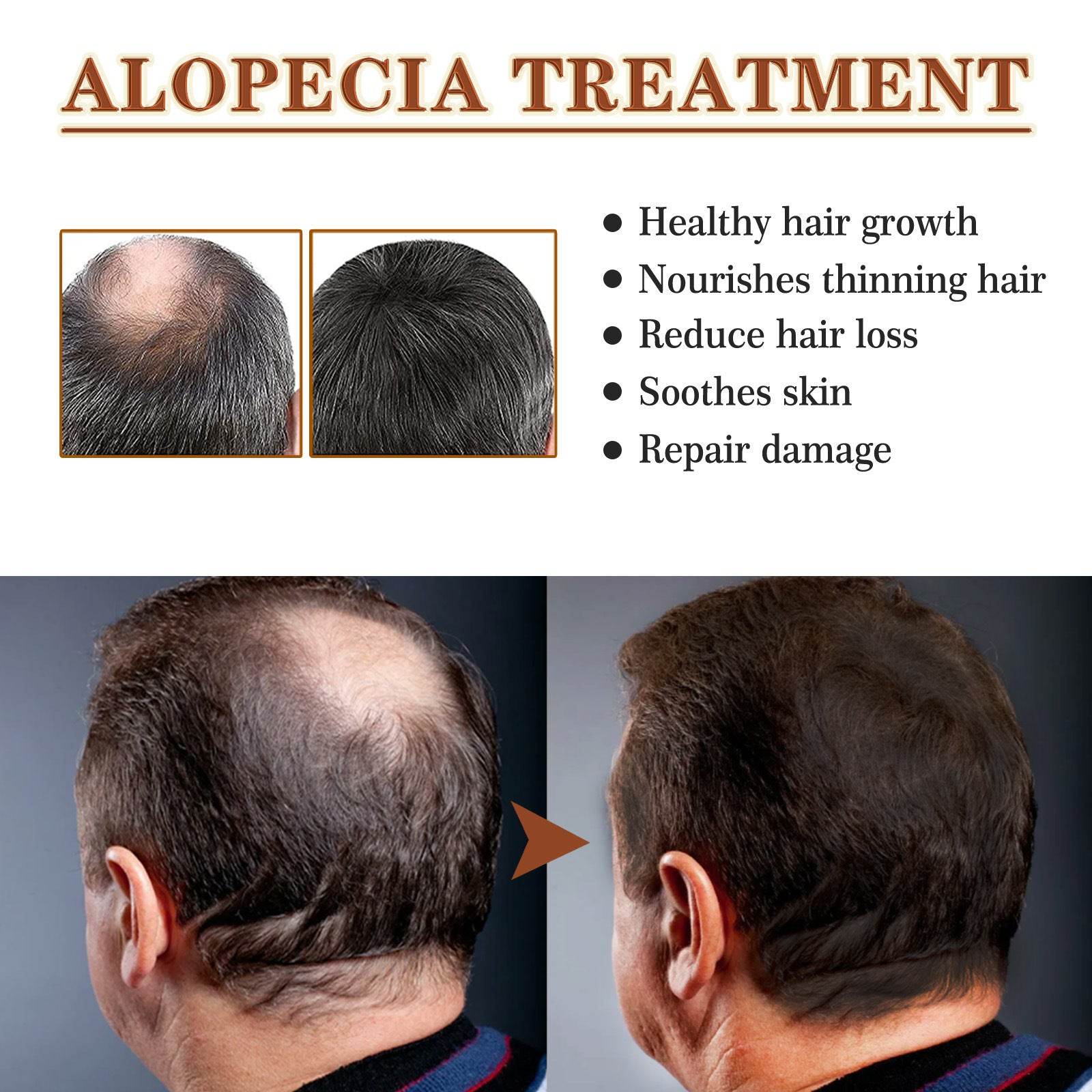 Dry And Manic Hair Growth Care Essential Oil - NamafadStore