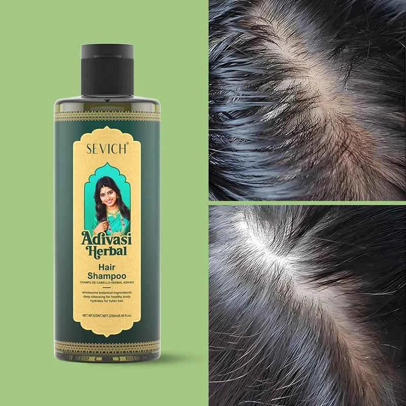 SEVICH Herbal Hair Growth Oil Set Ayurvedic Fast Hair Regrowth Thicken Serum India Adivasi Anti Hair Loss Hair Care Shampoo