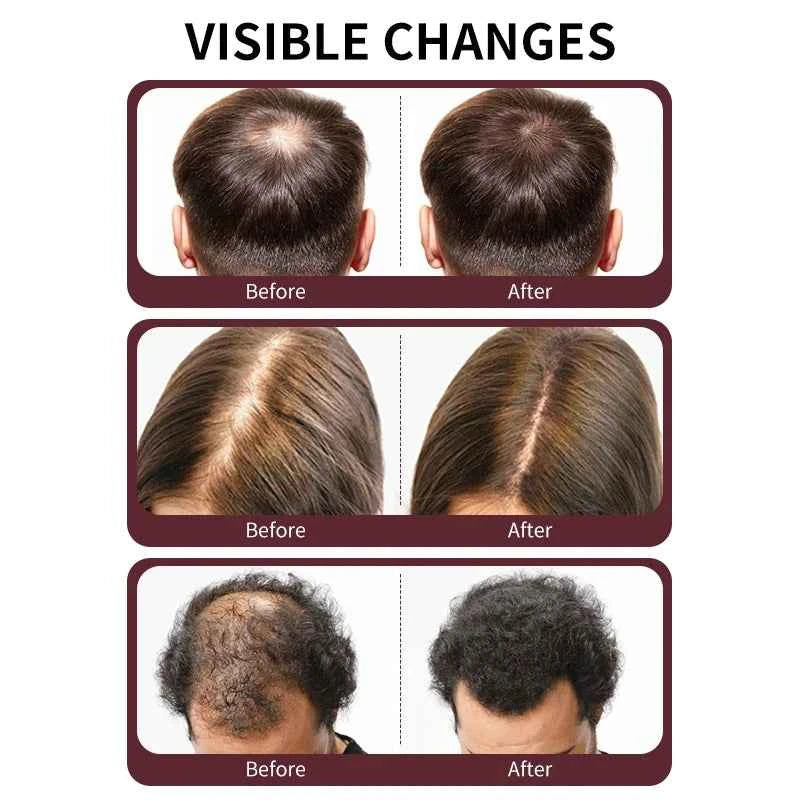 Batana Oil Shampoo for Hair Growth,Reduces Hair Loss Restores Hair Vitality and Rejuvenates,Stimulates Hair Growth,Repairs Damag