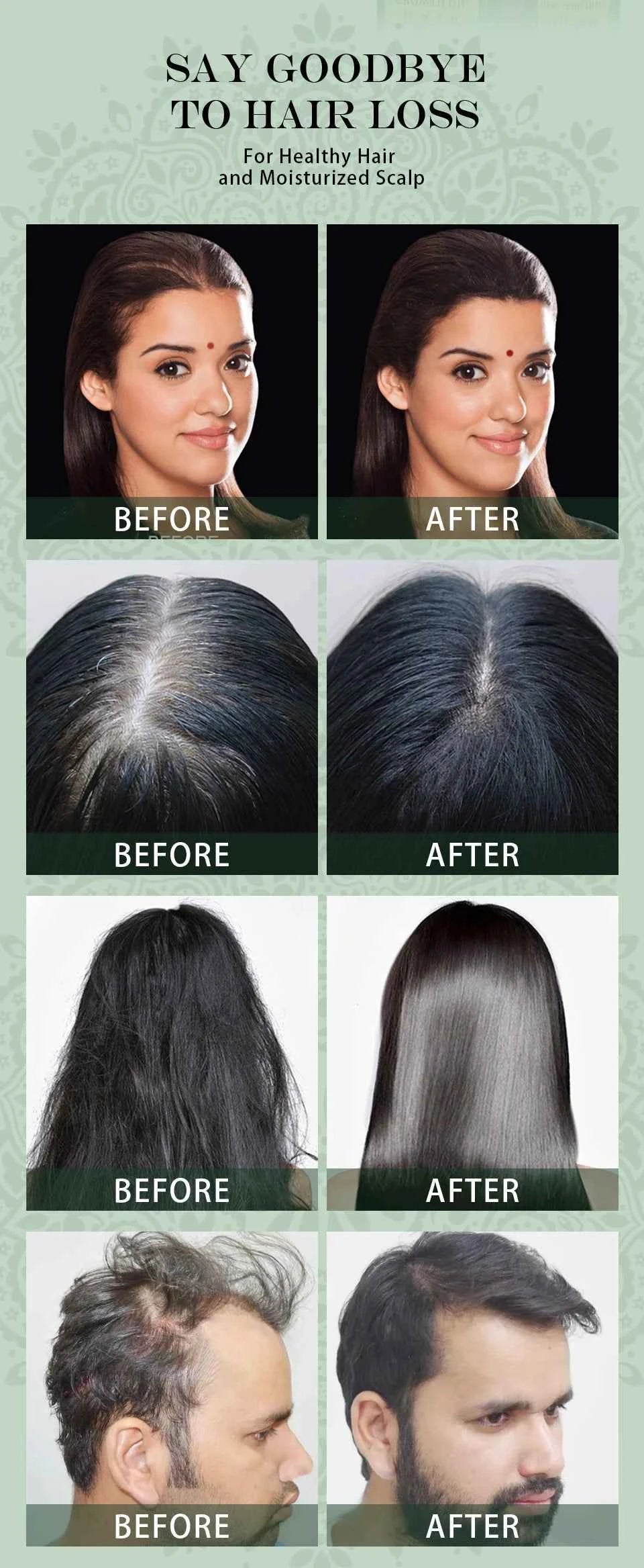 SEVICH Herbal Hair Growth Oil Set Ayurvedic Fast Hair Regrowth Thicken Serum India Adivasi Anti Hair Loss Hair Care Shampoo