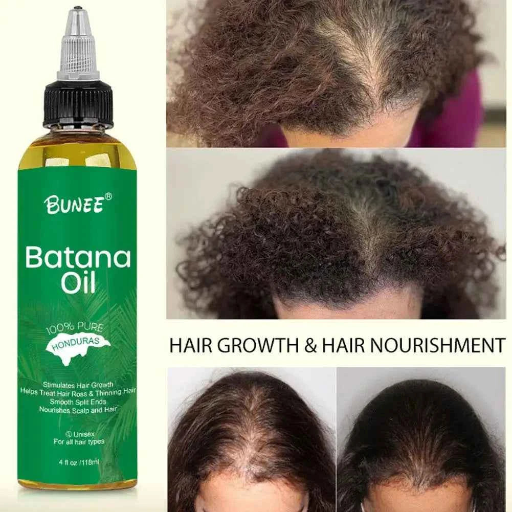 Batana Hair Care Essential Oil Repair Hair Root Moisturize Nourishing Strengthen Improve Split Smooth Hair Care Oil