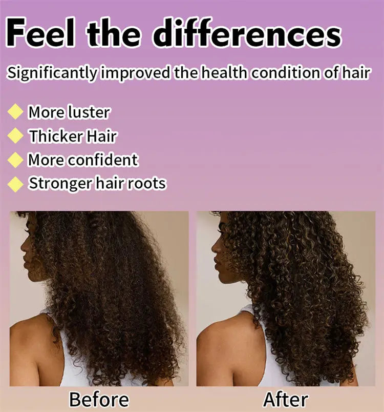 Maca Hair Growth Oil Set For Peru Maca Powder Hair Growth Butter Maca Root Hair Oil Castor Oil Anti-Hair Loss Sevich Hair Care