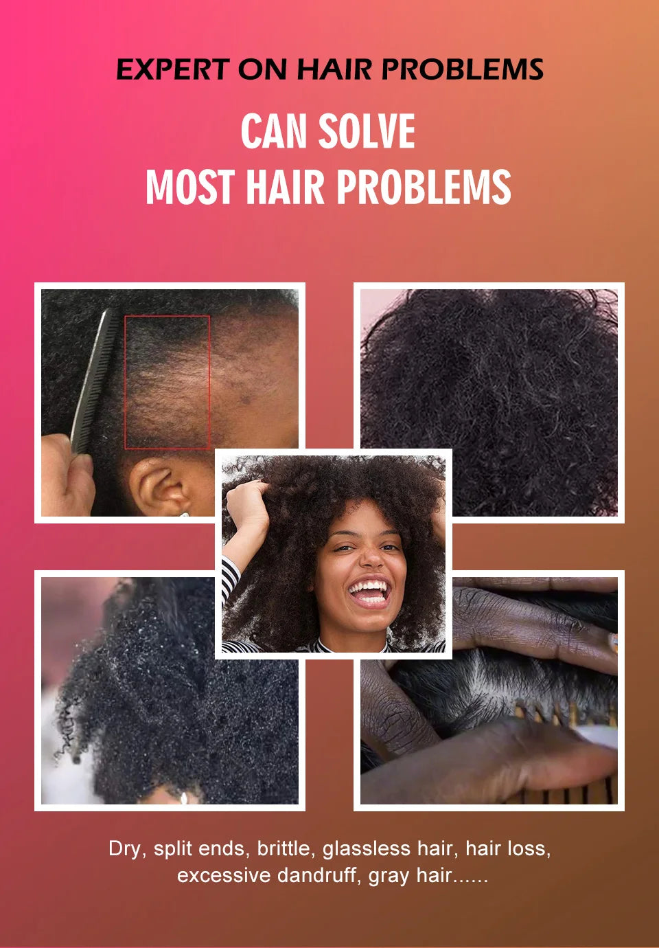 Natural 100% Pure Batana Oil For Hair Growth Batana Oil Butter Hair Mask From Honduras Hair Loss Treatment For Black Men & Women - NamafadStore