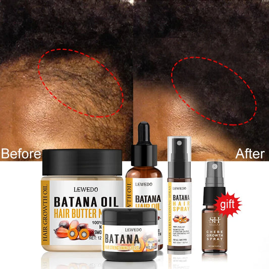Fast Hair Growth Oil Africa Crazy Traction Alopecia batana Hair Mask Anti Hair Break Hair Strengthener Hair Loss Treatment Spray - NamafadStore