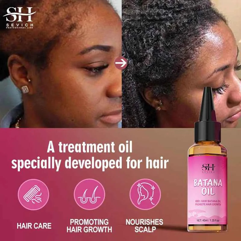 Natural 100% Pure Batana Oil For Hair Growth Butter Hair Mask Traction Alopecia Anti Hair Loss Baldness Treatment For Men Women