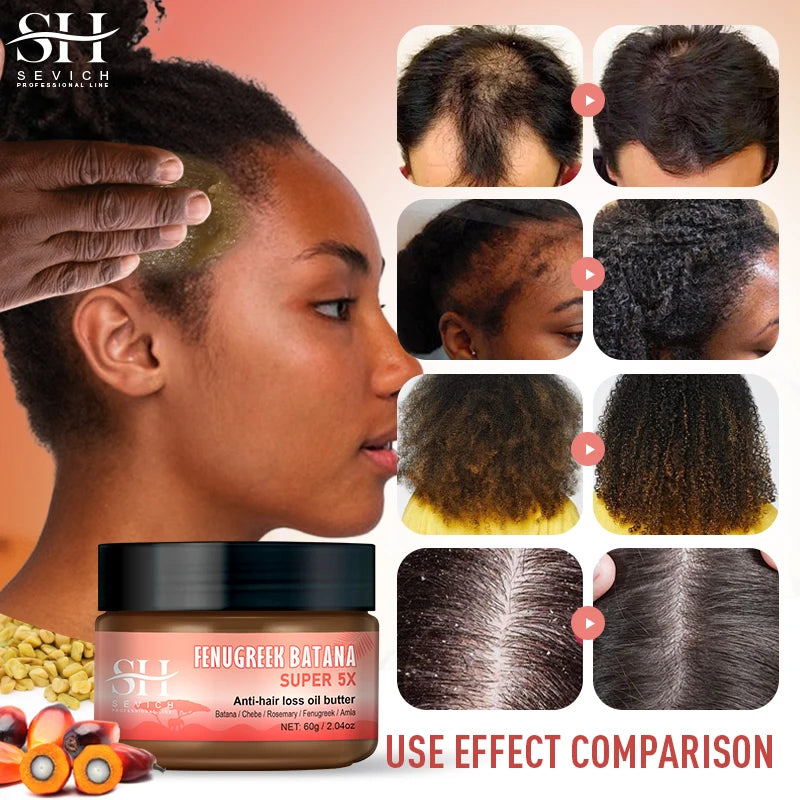 Hot Super 5x Hair Growth Oil Chebe Batana Butter Hair Mask Fenugreek Seeds Fast Anti-Hair Loss Oil Rosemary Hair Regrowth Oils - NamafadStore