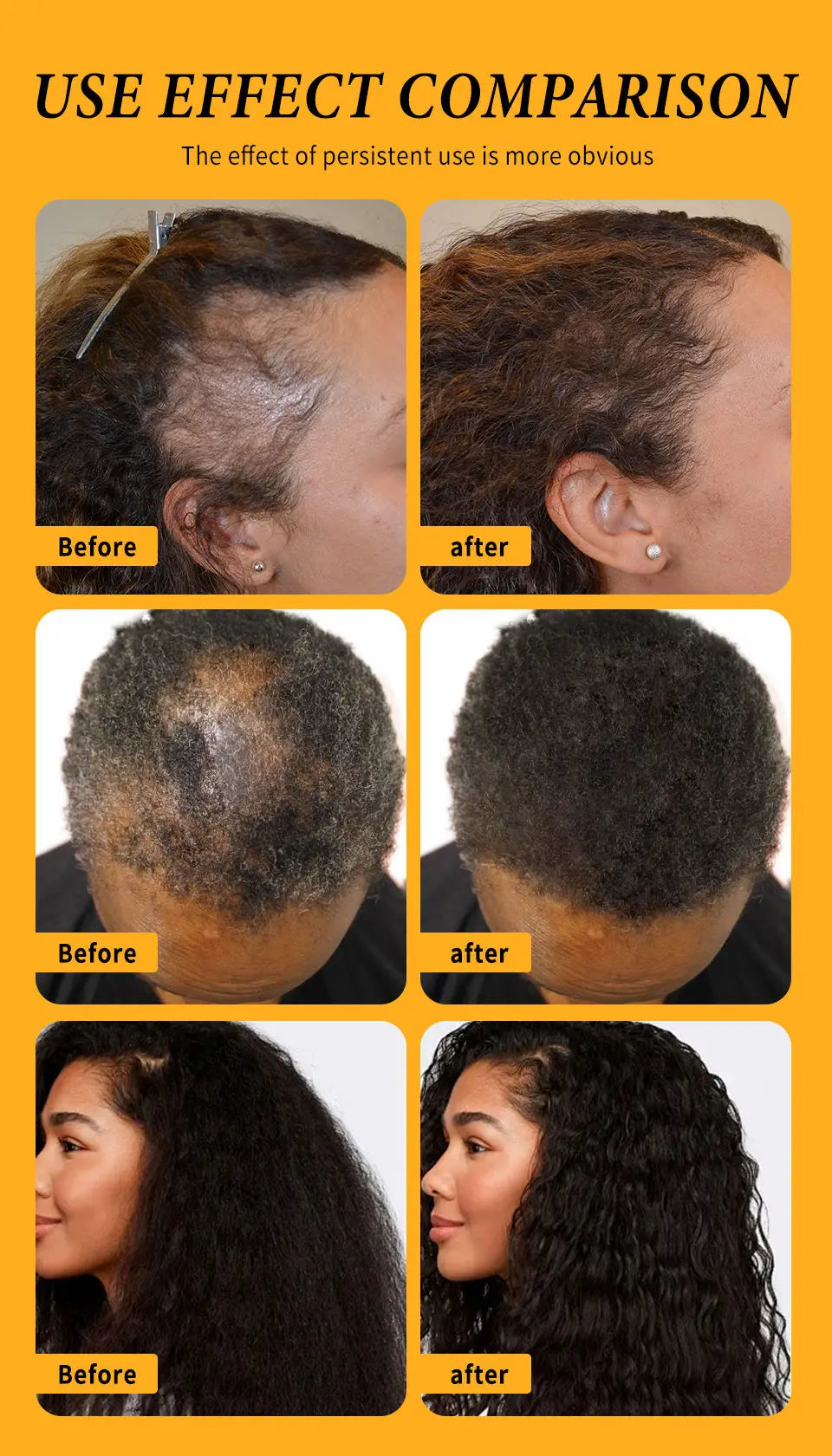 Fast Hair Growth Oil Africa Crazy Traction Alopecia batana Hair Mask Anti Hair Break Hair Strengthener Hair Loss Treatment Spray - NamafadStore