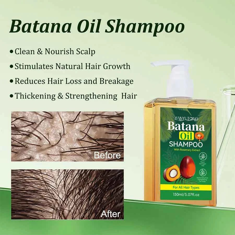 Organic Nourishing Batana Oil Shampoo & Conditioner Set for damaged hair, strengthens, prevents hair loss, and controls dandruff