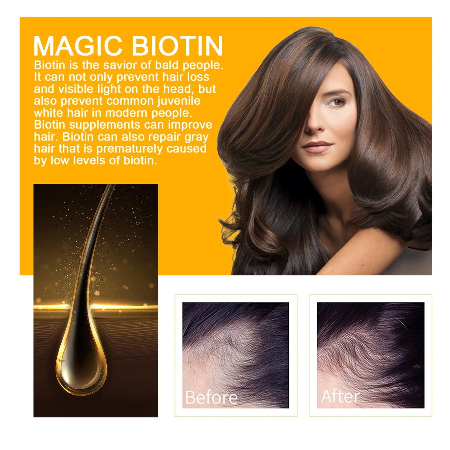 2pcs Biotin Hair Growth Solution Dense Hair Oil Deep Moisturising Scalp Massage Treatment Thickening & Smoothing Hair Care Oil
