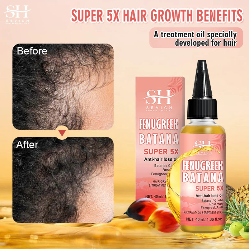 Hot Super 5x Hair Growth Oil Chebe Batana Butter Hair Mask Fenugreek Seeds Fast Anti-Hair Loss Oil Rosemary Hair Regrowth Oils - NamafadStore