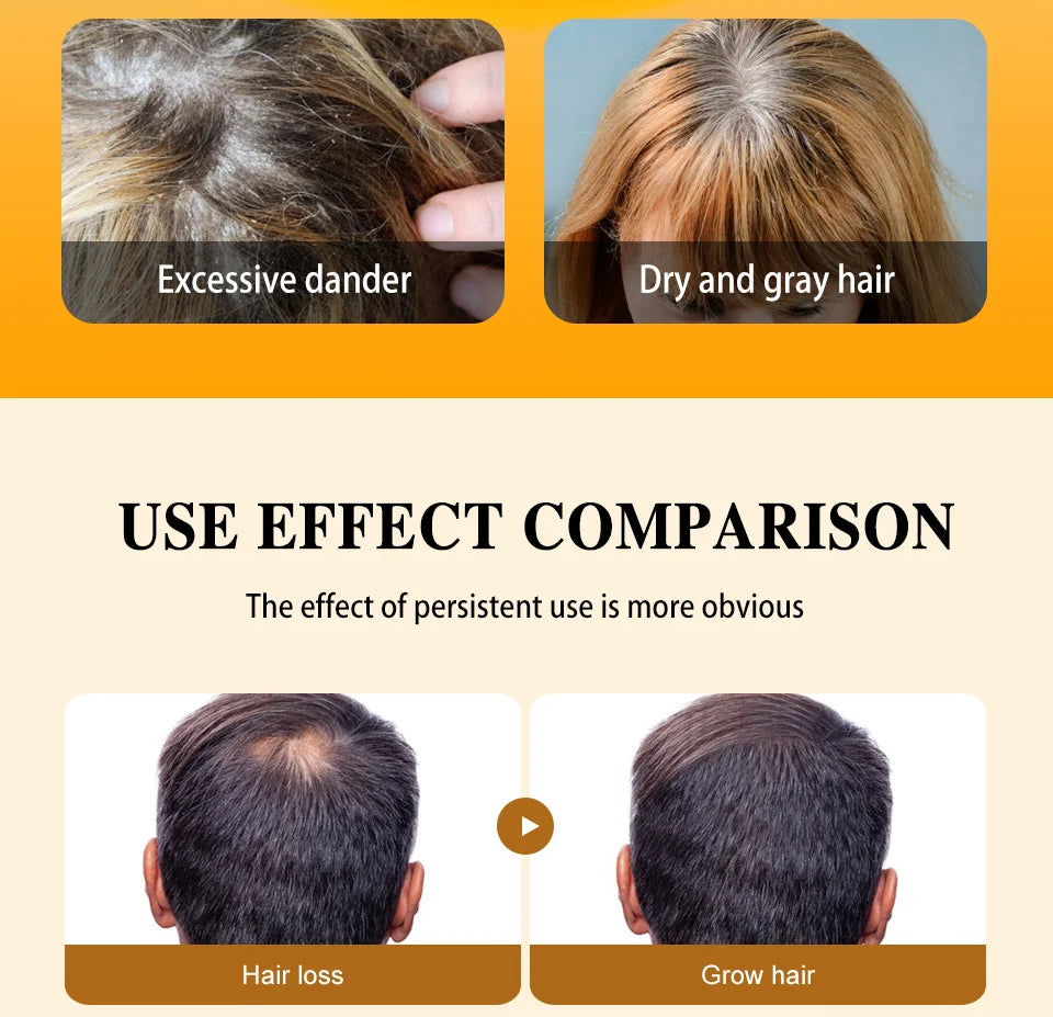 Fast Hair Growth Oil Africa Crazy Traction Alopecia batana Hair Mask Anti Hair Break Hair Strengthener Hair Loss Treatment Spray - NamafadStore