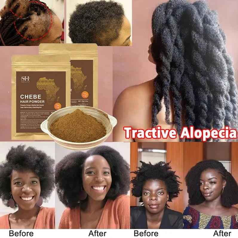 African Chebe Powder – Fast Hair Growth & Anti-Hair Loss Treatment