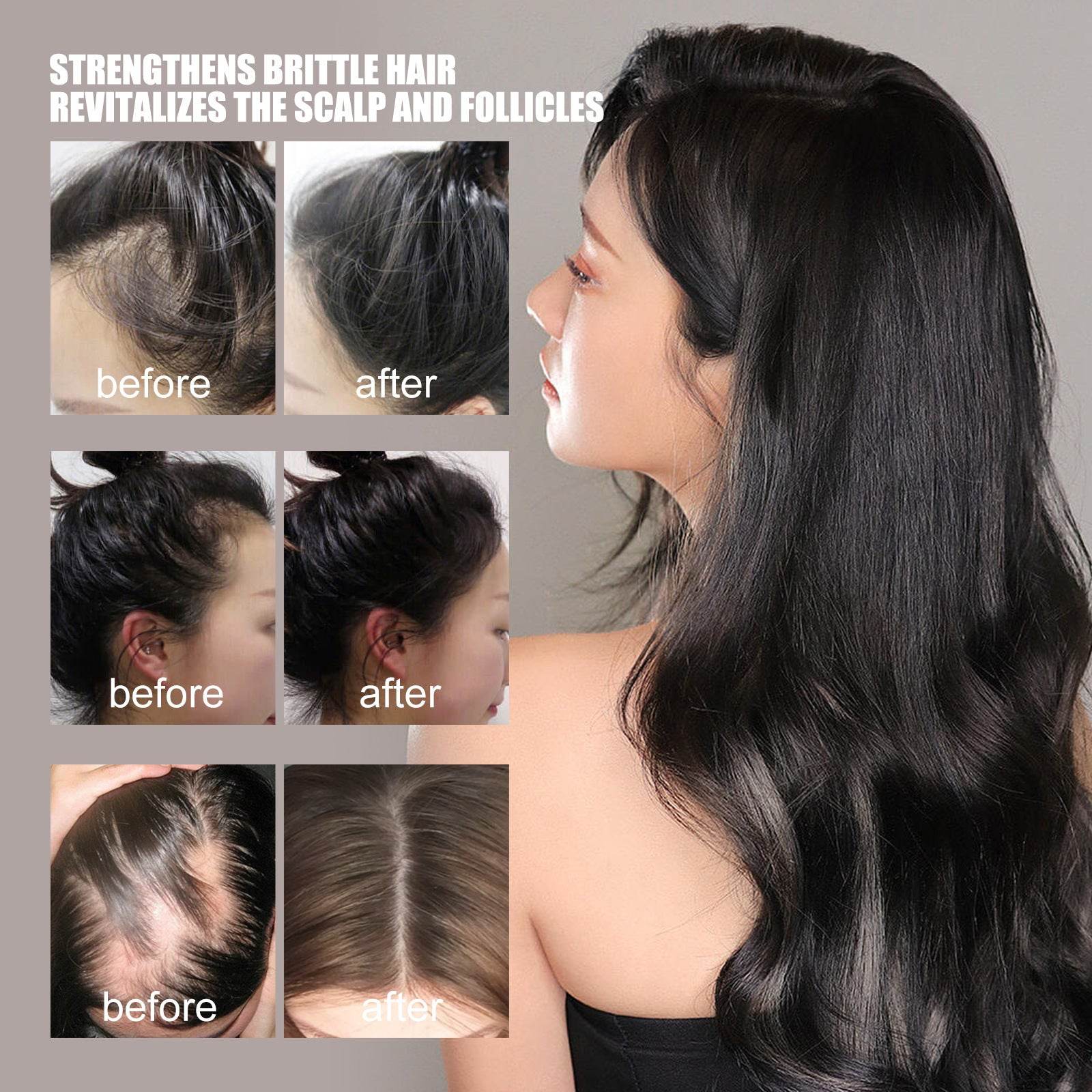 Hair Growth Essential Oil for Repair and Care - NamafadStore